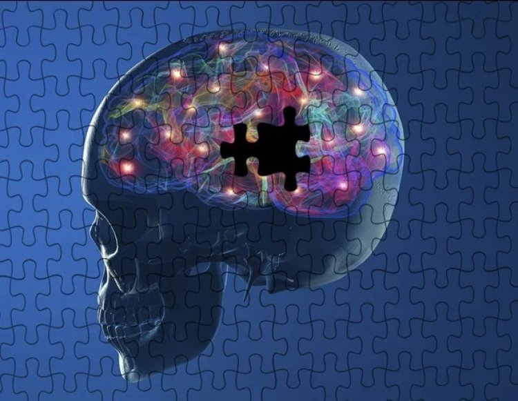 Researchers find cause of Parkinson’s upends common beliefs