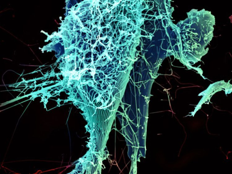 Researchers discover new way Ebola virus uses to infect cells