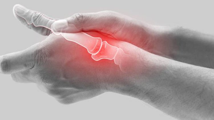 Researchers find how genetics affect need for surgery in patients with thumb osteoarthritis