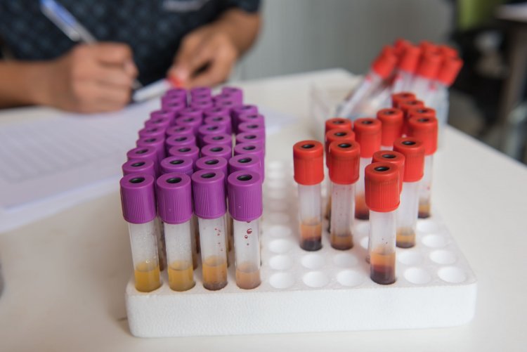 Researchers develop simple blood test to quickly diagnose sarcoidosis
