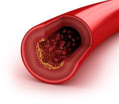 NILEMDO® Delivers Significant Cholesterol Lowering in Addition to Statin Therapy Which is Maintained During 2.5 Years of Treatment